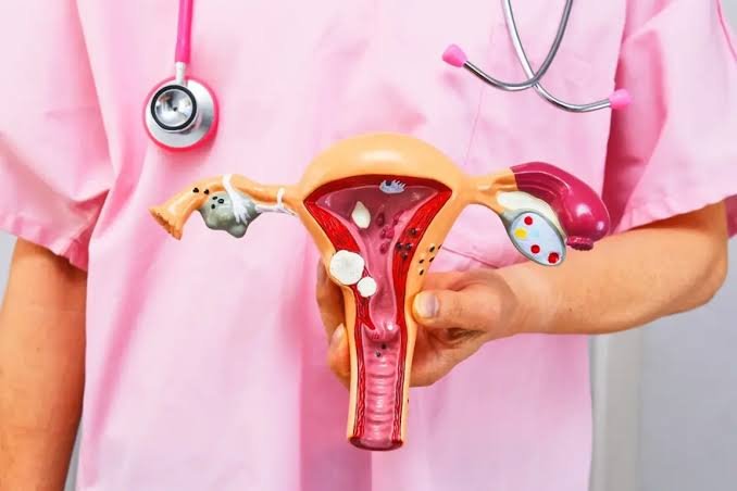 Planos de saúde terão que cobrir DIU hormonal em casos de endometriose